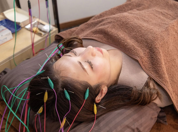 育毛治療の施術写真